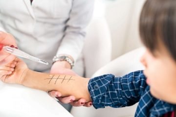 Child's Skin Allergy Test by Dr. Vivek Goswami
